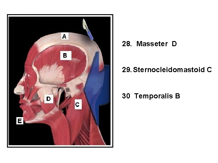 28. Masseter D 29. Sternocleidomastoid C 30 Temporalis B 