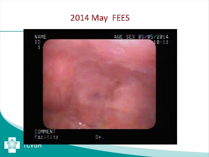 2014 May FEES 