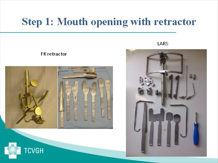 Step 1: Mouth opening with retractor LARS FK retractor 