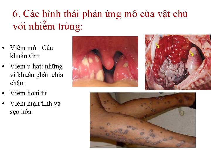 6. Các hình thái phản ứng mô của vật chủ với nhiễm trùng: •