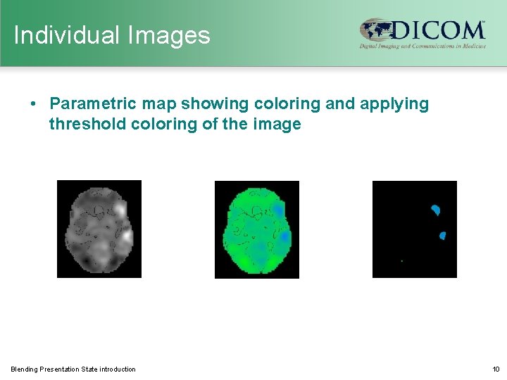 Individual Images • Parametric map showing coloring and applying threshold coloring of the image