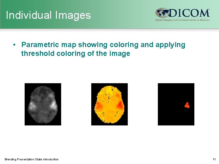 Individual Images • Parametric map showing coloring and applying threshold coloring of the image