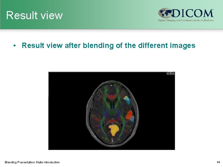 Result view • Result view after blending of the different images Blending Presentation State