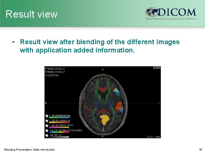 Result view • Result view after blending of the different images with application added