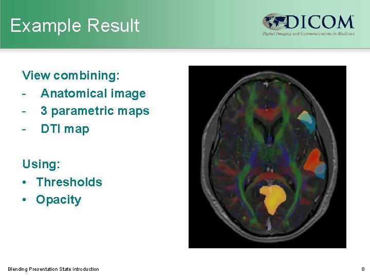 Example Result View combining: - Anatomical image - 3 parametric maps - DTI map