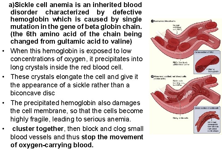  • • a)Sickle cell anemia is an inherited blood disorder characterized by defective