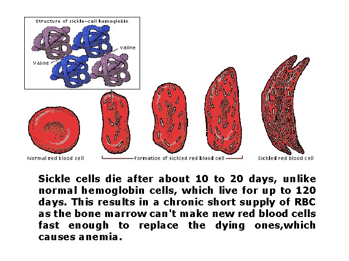 Sickle cells die after about 10 to 20 days, unlike normal hemoglobin cells, which