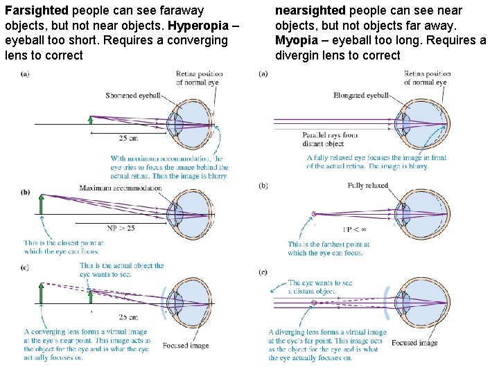 Farsighted people can see faraway objects, but not near objects. Hyperopia – eyeball too