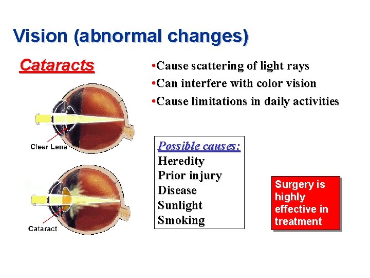 Vision (abnormal changes) Cataracts • Cause scattering of light rays • Can interfere with