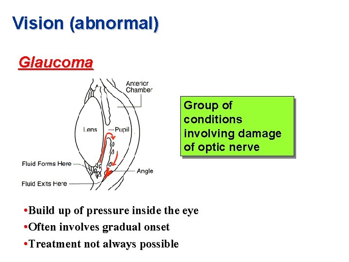 Vision (abnormal) Glaucoma Group of conditions involving damage of optic nerve • Build up