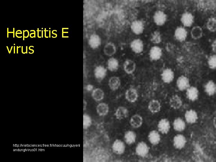Hepatitis E virus http: //vietsciences. free. fr/khaocuu/nguyenl andung/virus 01. htm 