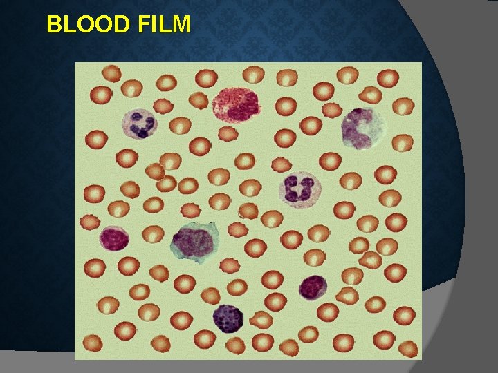 BLOOD FILM  BLOOD FILM
