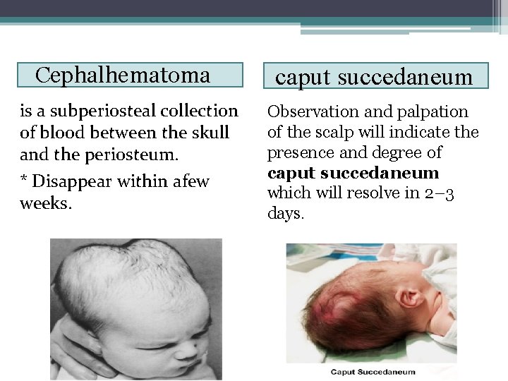 Cephalhematoma is a subperiosteal collection of blood between the skull and the periosteum. *