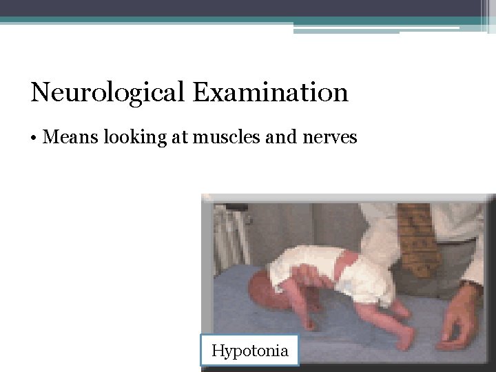Neurological Examination • Means looking at muscles and nerves Hypotonia 