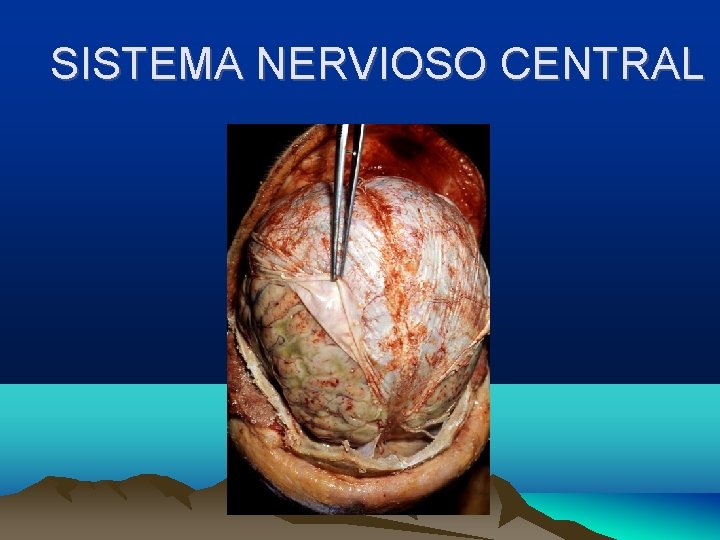 SISTEMA NERVIOSO CENTRAL 