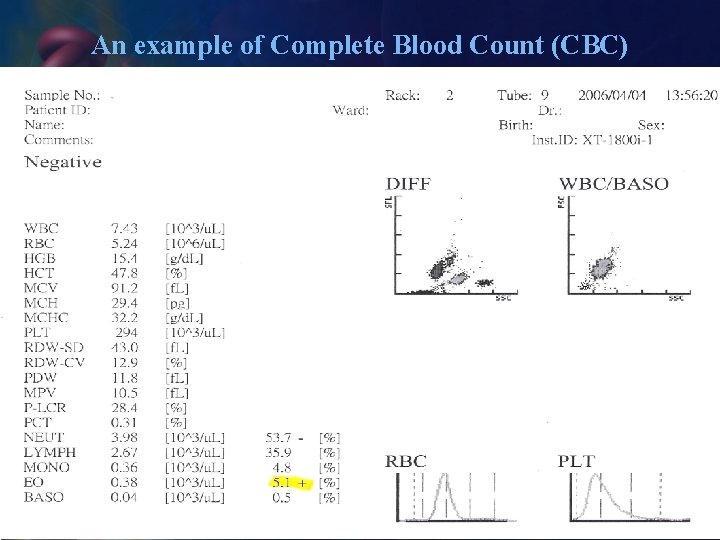 An example of Complete Blood Count (CBC) 