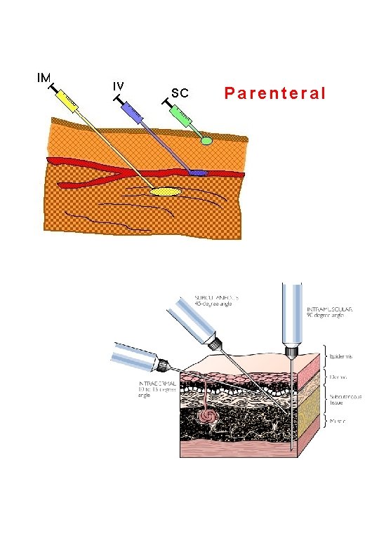 Parenteral 