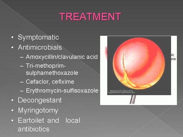 TREATMENT • Symptomatic • Antimicrobials – Amoxycillin/clavulanic acid – Tri-methoprimsulphamethoxazole – Cefaclor, cefixime –