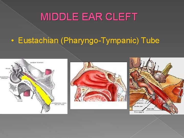 MIDDLE EAR CLEFT • Eustachian (Pharyngo-Tympanic) Tube 