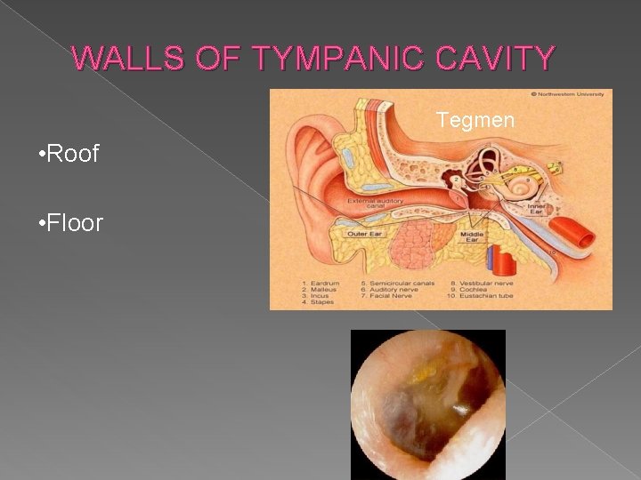 WALLS OF TYMPANIC CAVITY Tegmen • Roof • Floor 