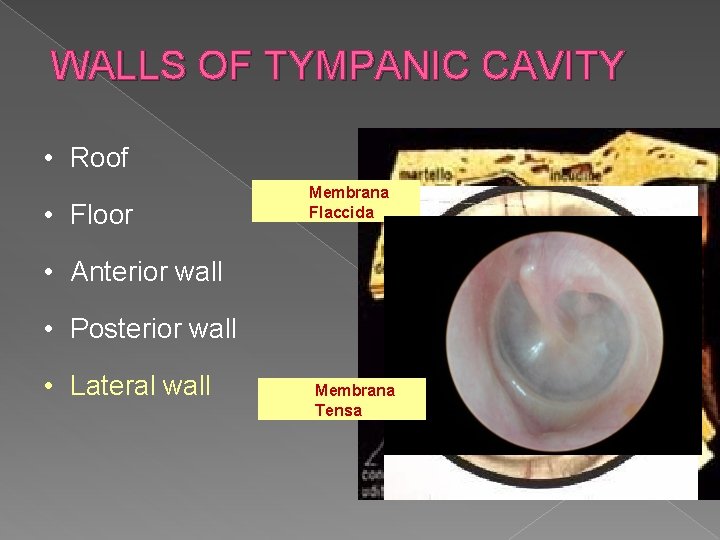 WALLS OF TYMPANIC CAVITY • Roof • Floor Membrana Flaccida • Anterior wall •