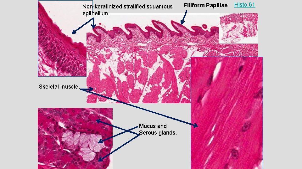 Non-keratinized stratified squamous epithelium. Skeletal muscle, Mucus and Serous glands, Filiform Papillae Histo 51