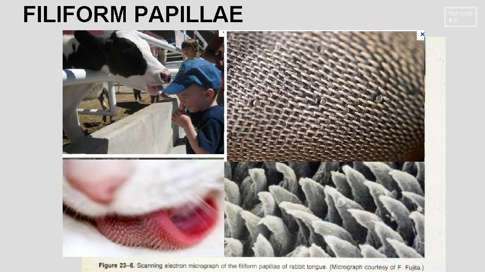 FILIFORM PAPILLAE Ref code #6 