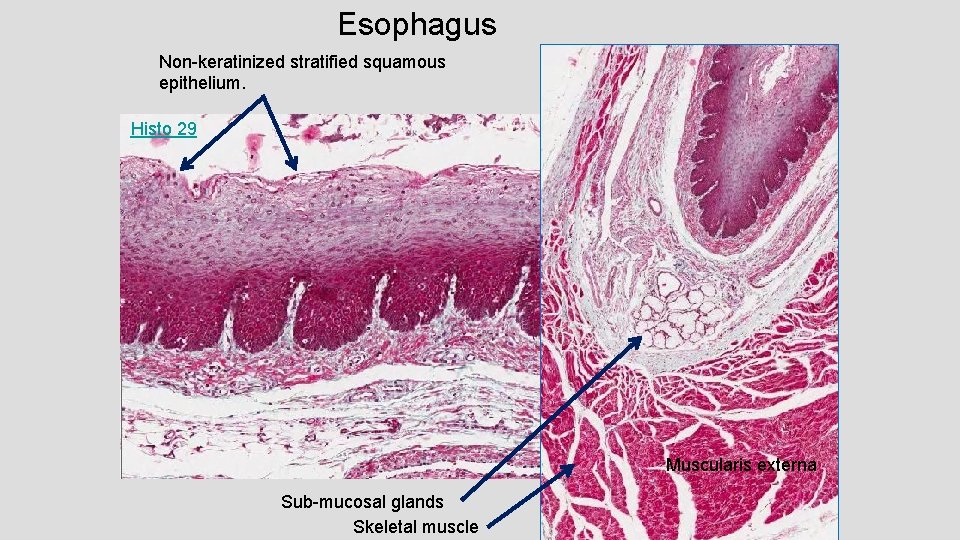 Esophagus Non-keratinized stratified squamous epithelium. Histo 29 Muscularis externa Sub-mucosal glands Skeletal muscle 