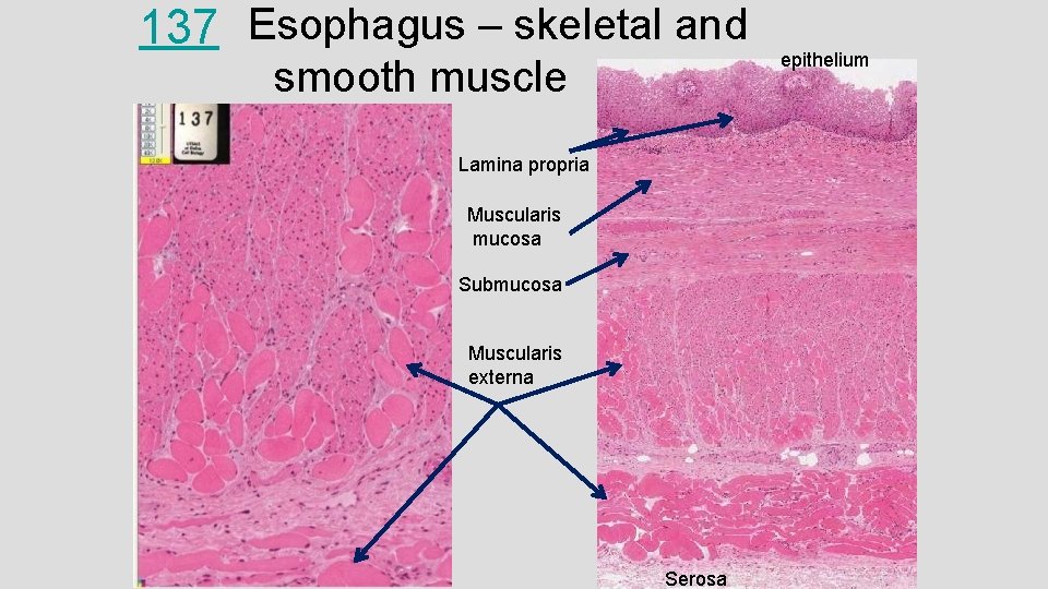 137 Esophagus – skeletal and smooth muscle Lamina propria Muscularis mucosa Submucosa Muscularis externa