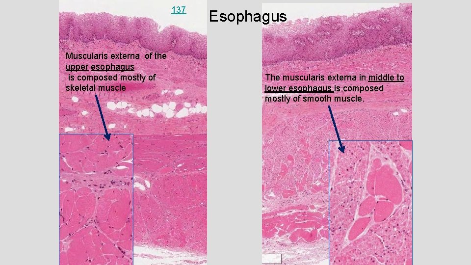 137 Muscularis externa of the upper esophagus is composed mostly of skeletal muscle Esophagus