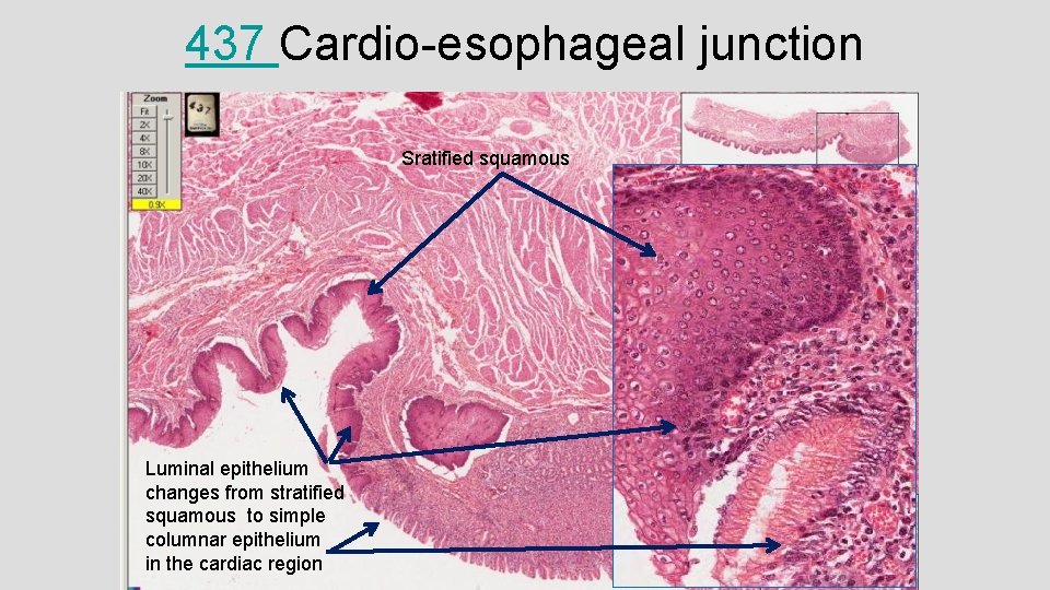 437 Cardio-esophageal junction Sratified squamous Luminal epithelium changes from stratified squamous to simple columnar