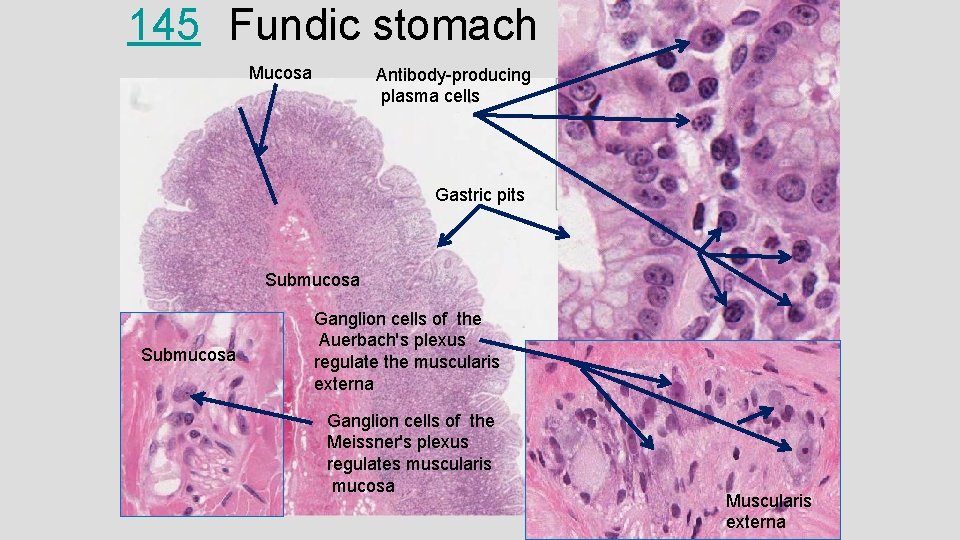 145 Fundic stomach Mucosa Antibody-producing plasma cells Gastric pits Submucosa Ganglion cells of the