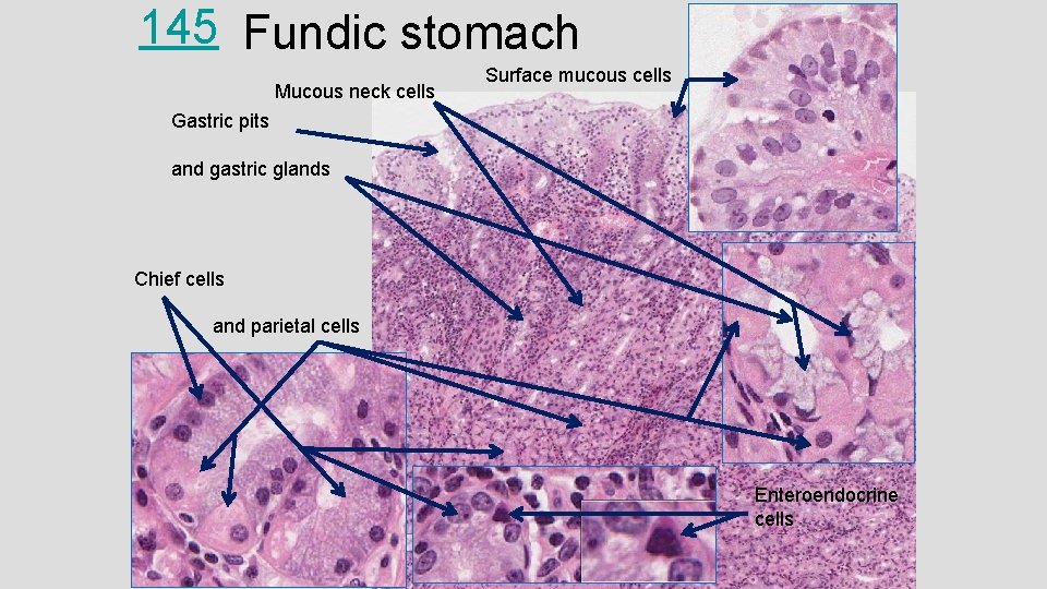 145 Fundic stomach Mucous neck cells Surface mucous cells Gastric pits and gastric glands