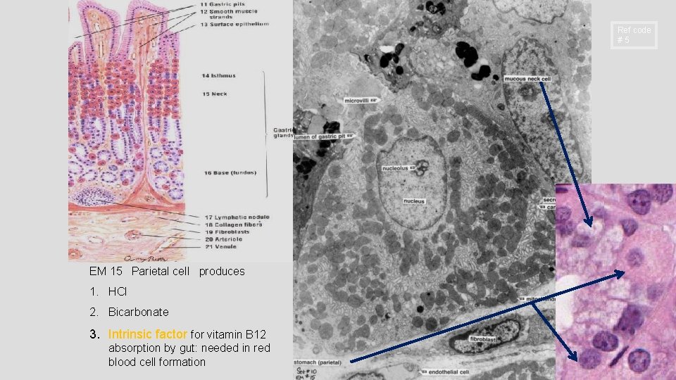 Ref code #5 EM 15 Parietal cell produces 1. HCl 2. Bicarbonate 3. Intrinsic