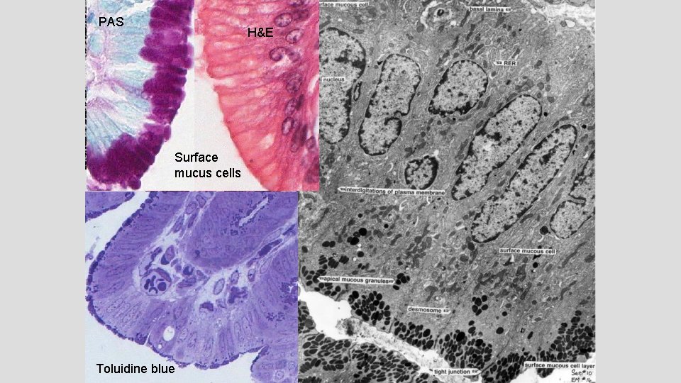 PAS H&E Surface mucus cells EM 16 • Granules of surface mucous cells •