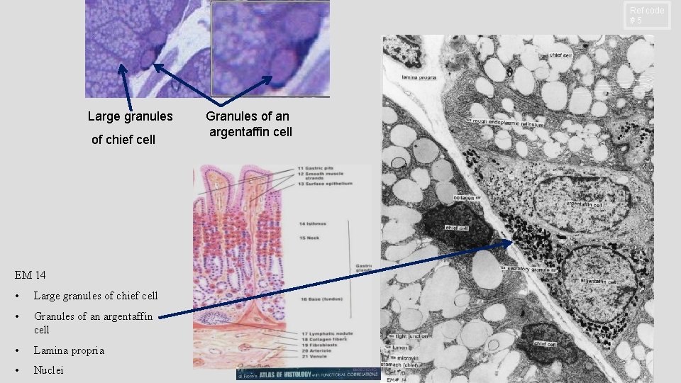 Ref code #5 Large granules of chief cell EM 14 • Large granules of