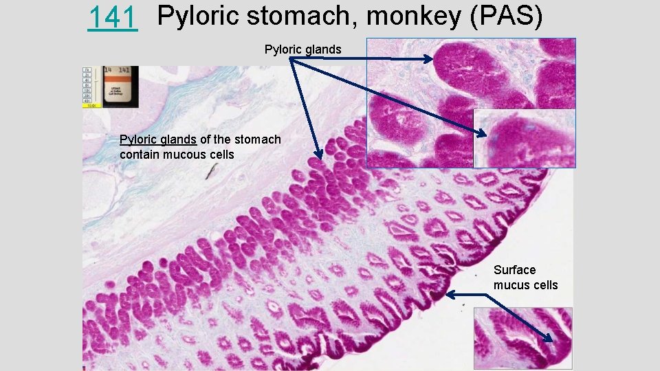 141 Pyloric stomach, monkey (PAS) Pyloric glands of the stomach contain mucous cells Surface
