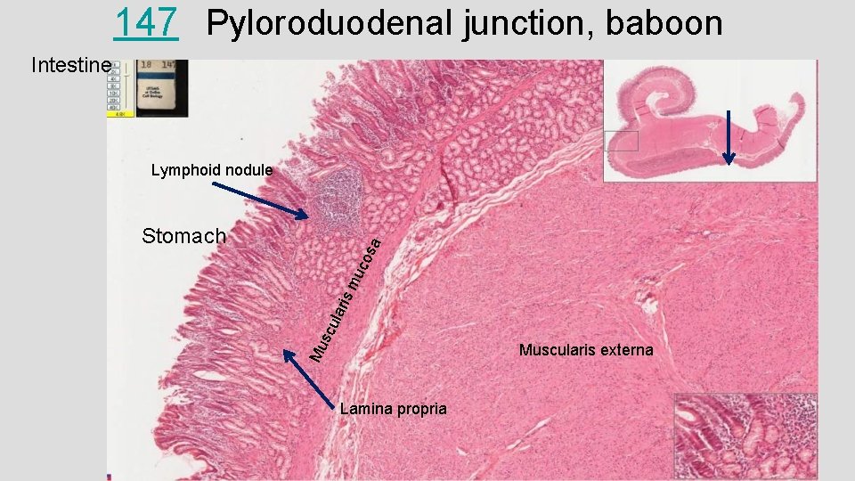 147 Pyloroduodenal junction, baboon Intestine Lymphoid nodule Mu sc ula ris mu co sa
