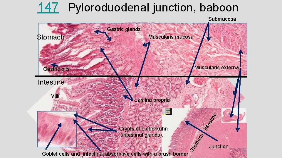 147 Pyloroduodenal junction, baboon Submucosa Gastric glands Stomach Muscularis mucosa Muscularis externa Gastric pits