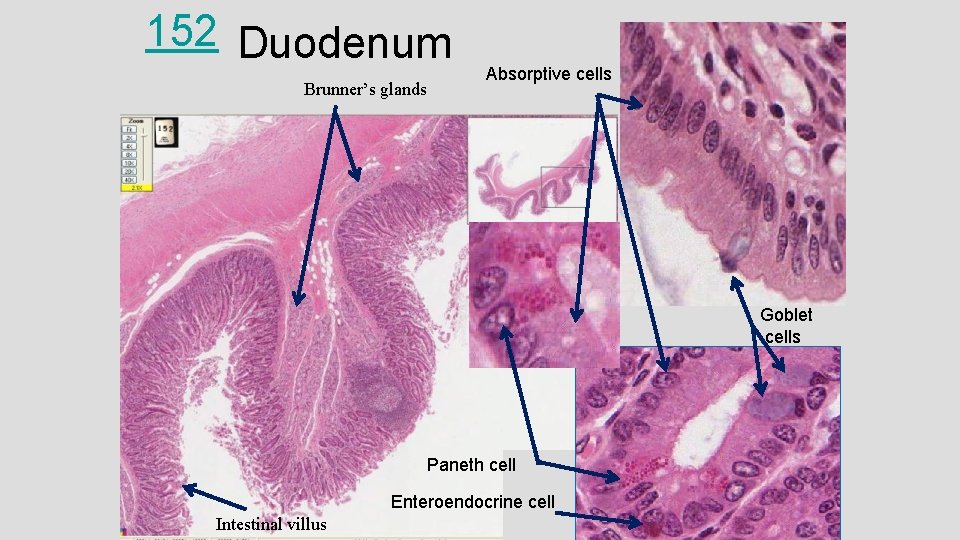 152 Duodenum Brunner’s glands Absorptive cells Goblet cells Paneth cell Enteroendocrine cell Intestinal villus