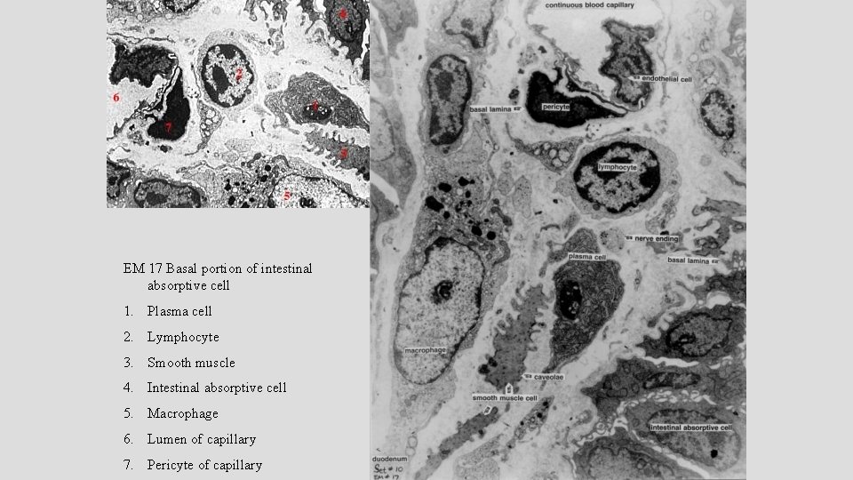 EM 17 Basal portion of intestinal absorptive cell 1. Plasma cell 2. Lymphocyte 3.