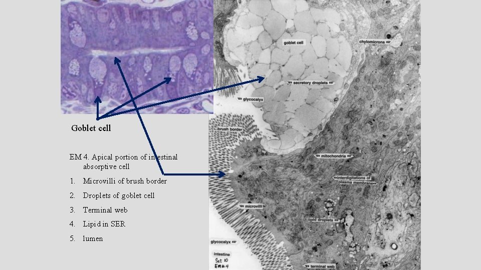 Goblet cell EM 4. Apical portion of intestinal absorptive cell 1. Microvilli of brush