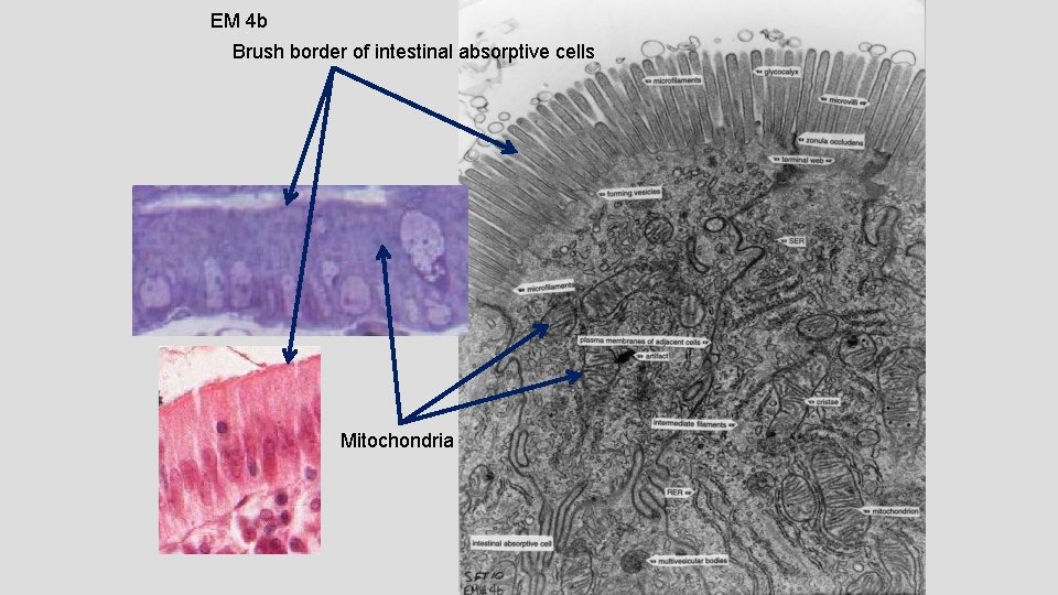 EM 4 b Brush border of intestinal absorptive cells Mitochondria 