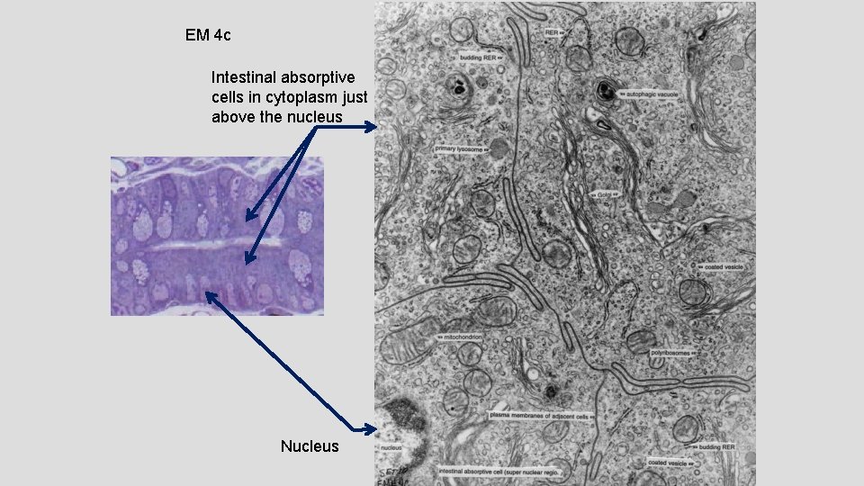 EM 4 c Intestinal absorptive cells in cytoplasm just above the nucleus Nucleus 