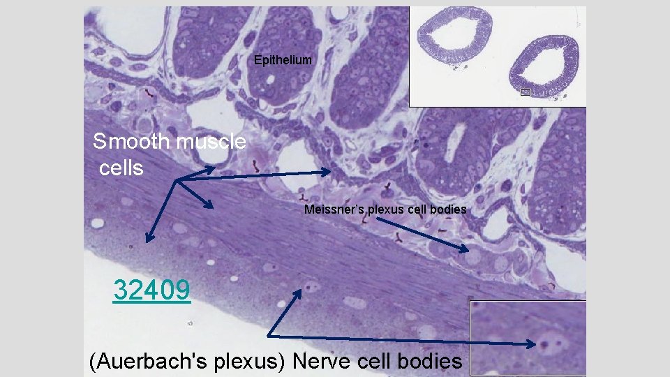 Epithelium Smooth muscle cells Meissner’s plexus cell bodies 32409 (Auerbach's plexus) Nerve cell bodies
