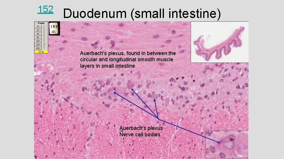 152 Duodenum (small intestine) Auerbach's plexus, found in between the circular and longitudinal smooth