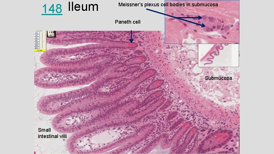 148 Ileum Meissner’s plexus cell bodies in submucosa Paneth cell Submucosa Small intestinal villi