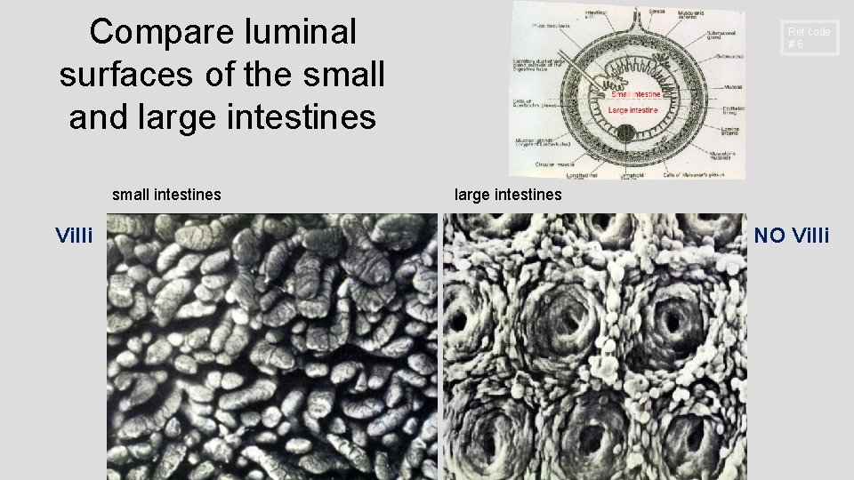 Compare luminal surfaces of the small and large intestines small intestines Villi Ref code
