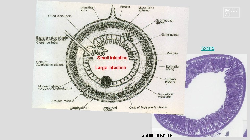Ref code # 6 32409 Small intestine Large intestine Small intestine 