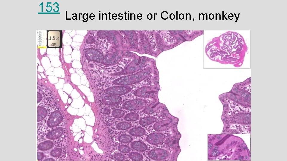 153 Large intestine or Colon, monkey 